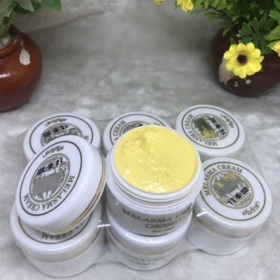 Kem Face Melasma Trắng